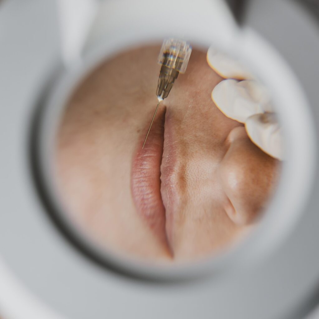 skin specialist in south delhi Sarin Skin Solution