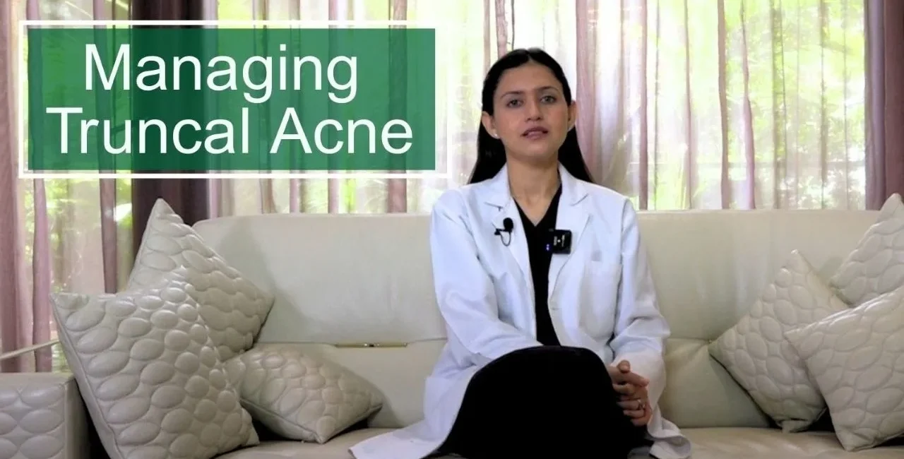 best skin clinic in south delhi Sarin Skin Solution